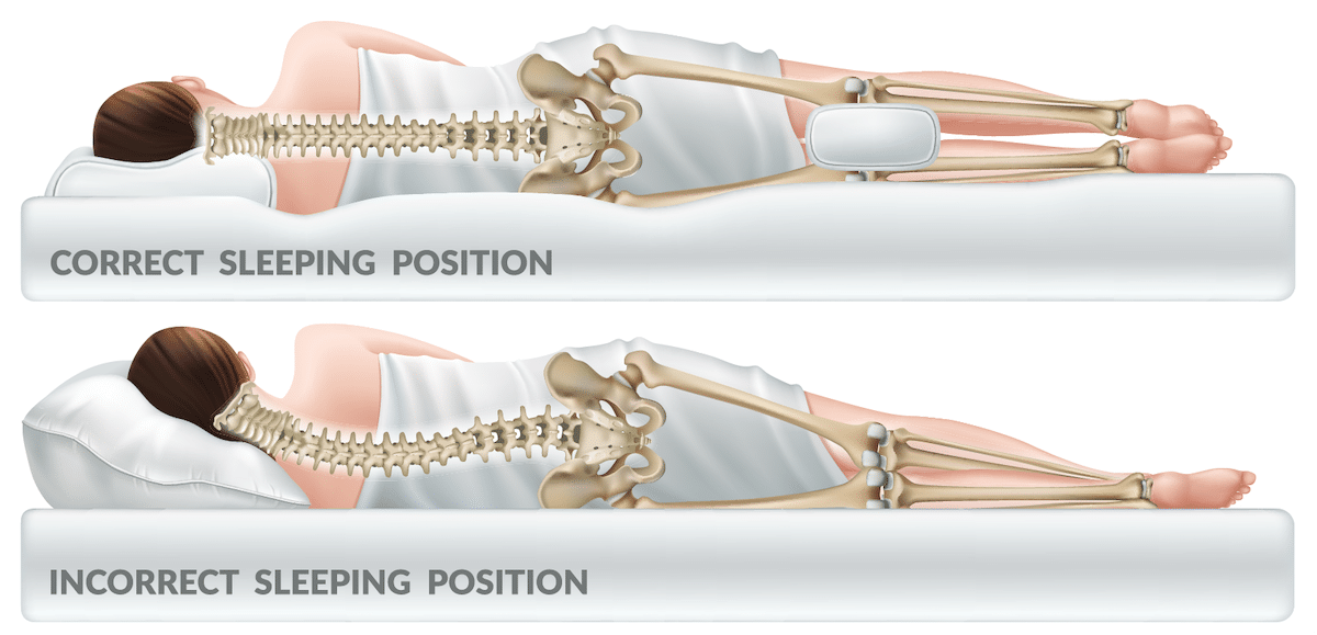 diagram of proper sleeping position and incorrect sleeping position.