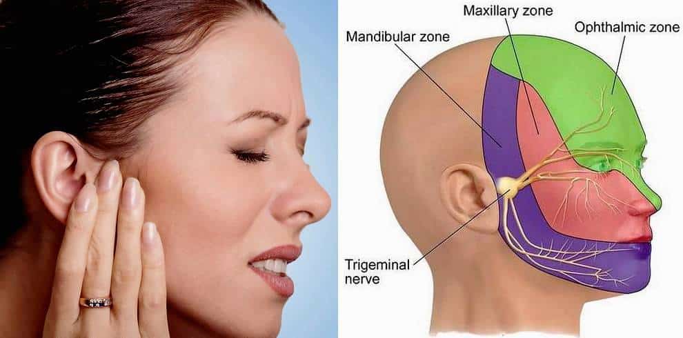 trigeminal neuropathy causing pain in the ear